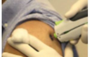 Needle-free Injection – Eradicating Diseases to Improve Global Health